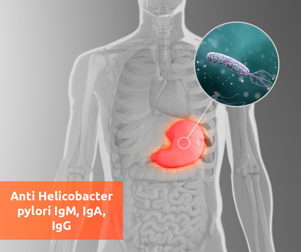 Anti Helicobacter pylori IgM, IgA, IgG