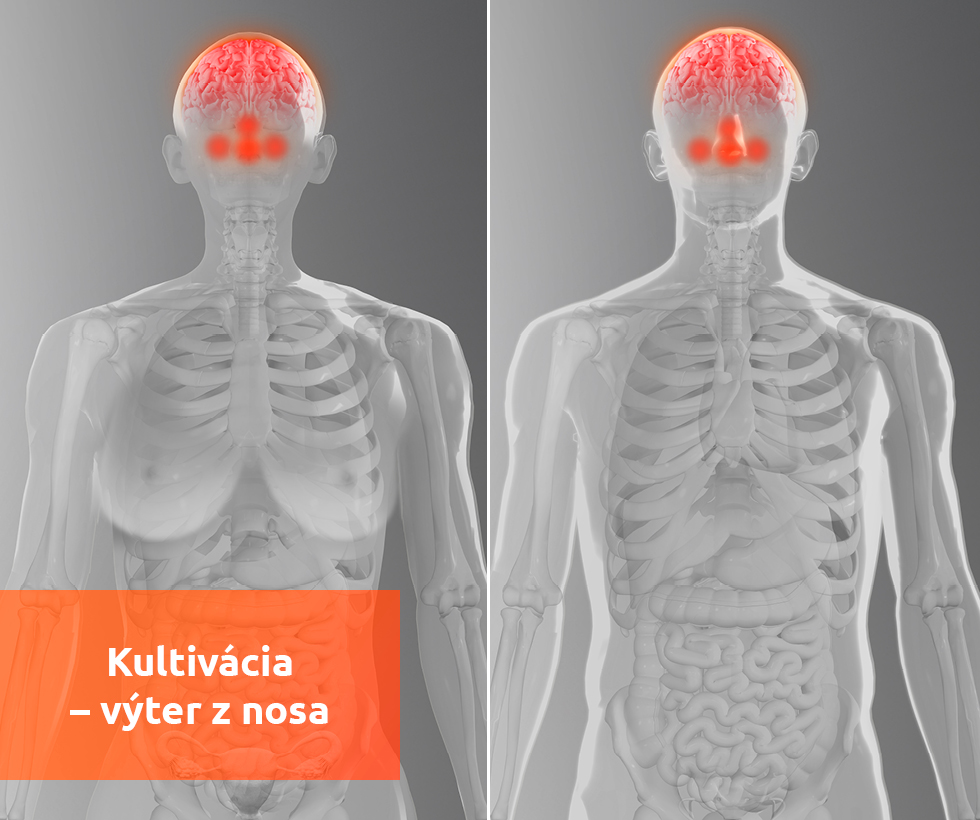 Kultivácia – Výter Z Nosa Lab Online