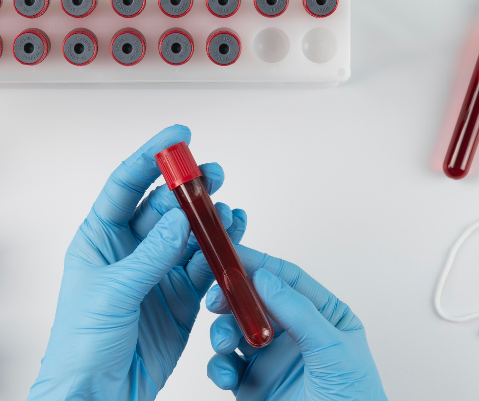 Blood group test | Unilabs Online | Laboratory tests