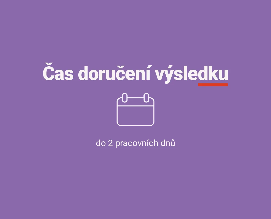Test na drogy z moči v Unilabs - čas doručení výsledku