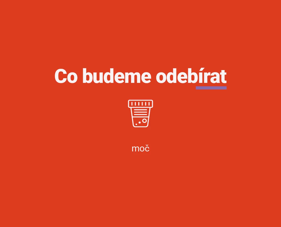 Test na drogy z moči v Unilabs - materiál odběru